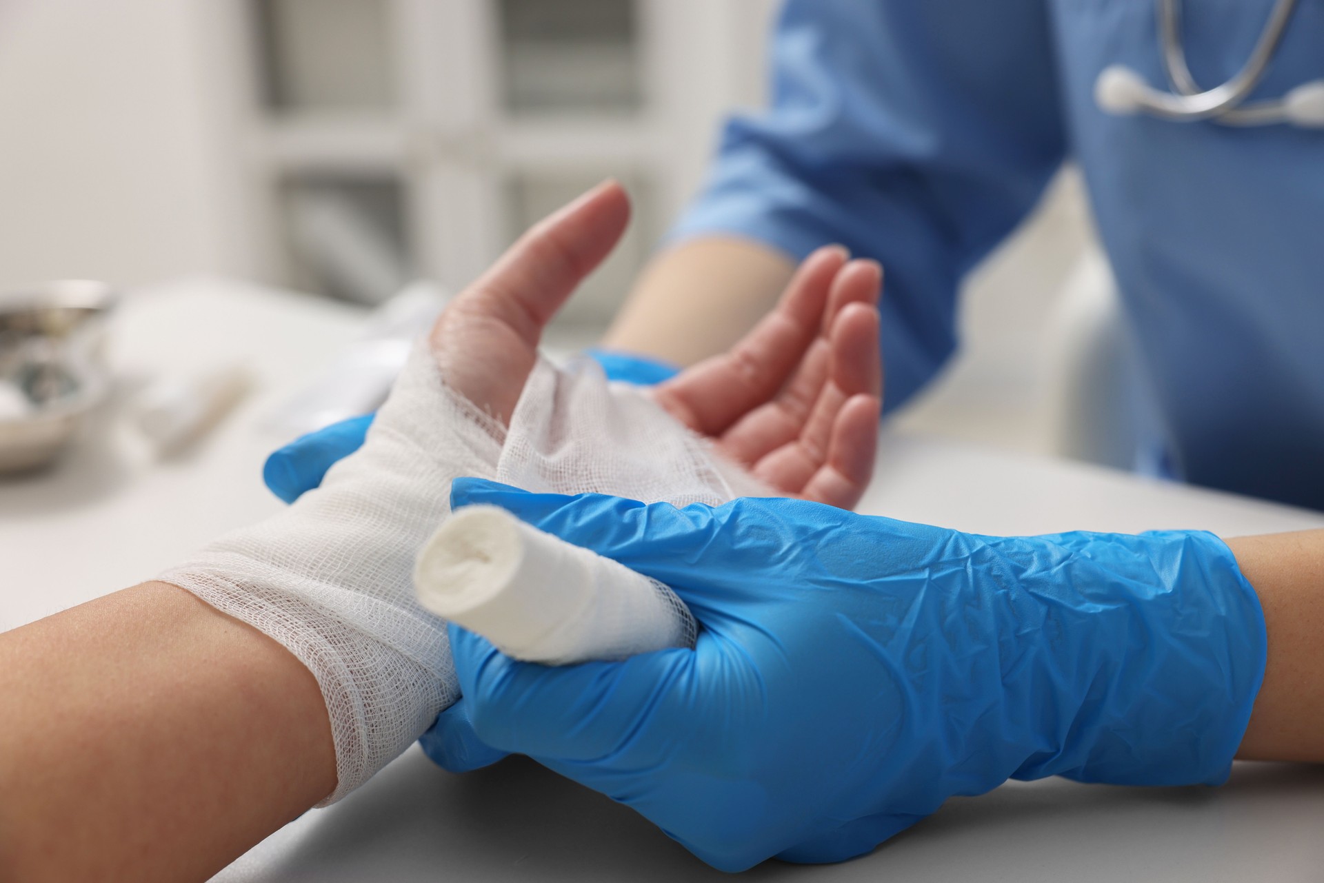Médico vendando la mano quemada de un paciente en el hospital, primer plano